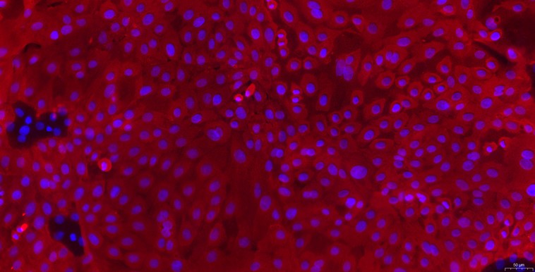 Primary Rabbit Gingival Epithelial Cells (GiEC)