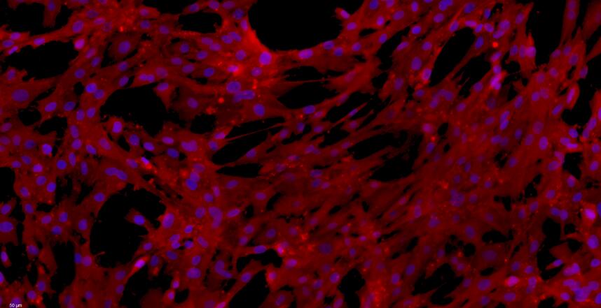 Primary Mouse Skeletal Muscle Myoblasts (SMM)