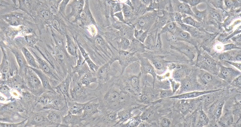 Primary Rat Skeletal Muscle Myoblasts (SMM)