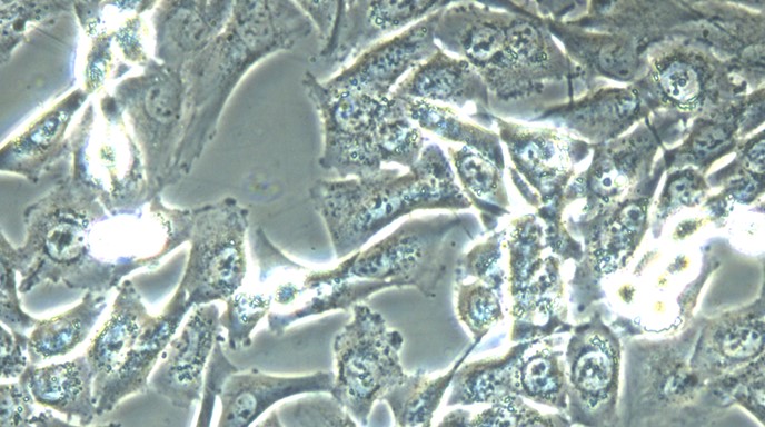 Human Lung Adenocarcinoma Cells (LA)