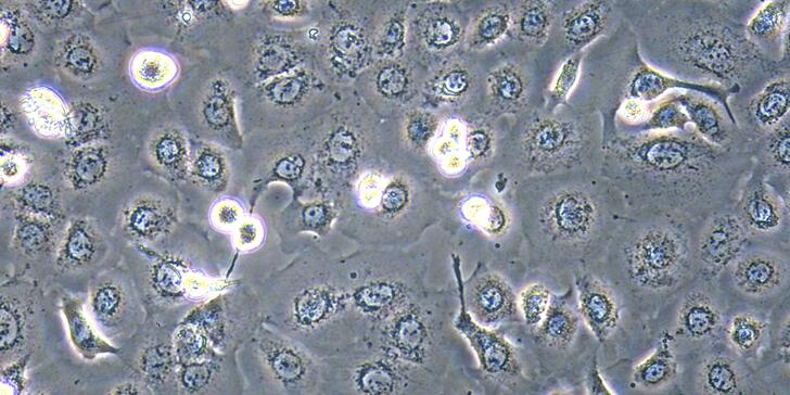 Human TE-1 Esophageal Carcinoma Cells (TE-1)