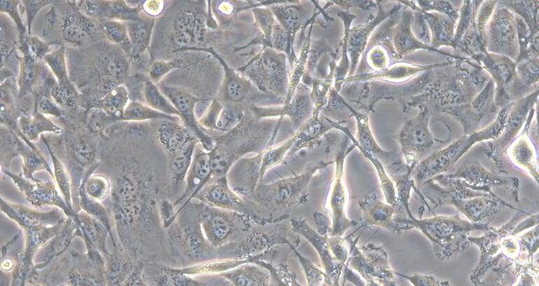 Human Fibrosarcoma Cells (FSC)