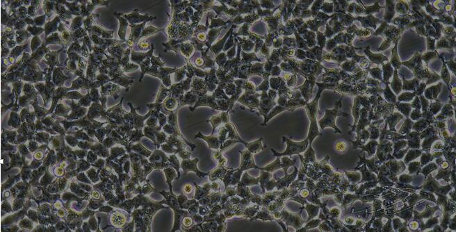 Human Embryonic Kidney Epithelial Cells (EKC)