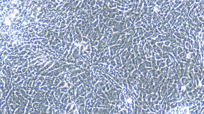 Primary Mouse Peritoneal Mesothelial Cells (PMC)