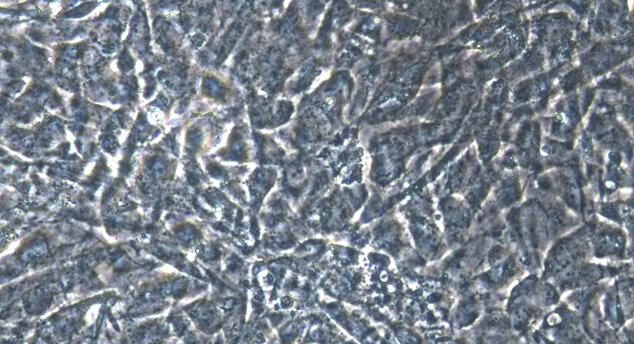 Primary Mouse Peritoneal Mesothelial Cells (PMC)