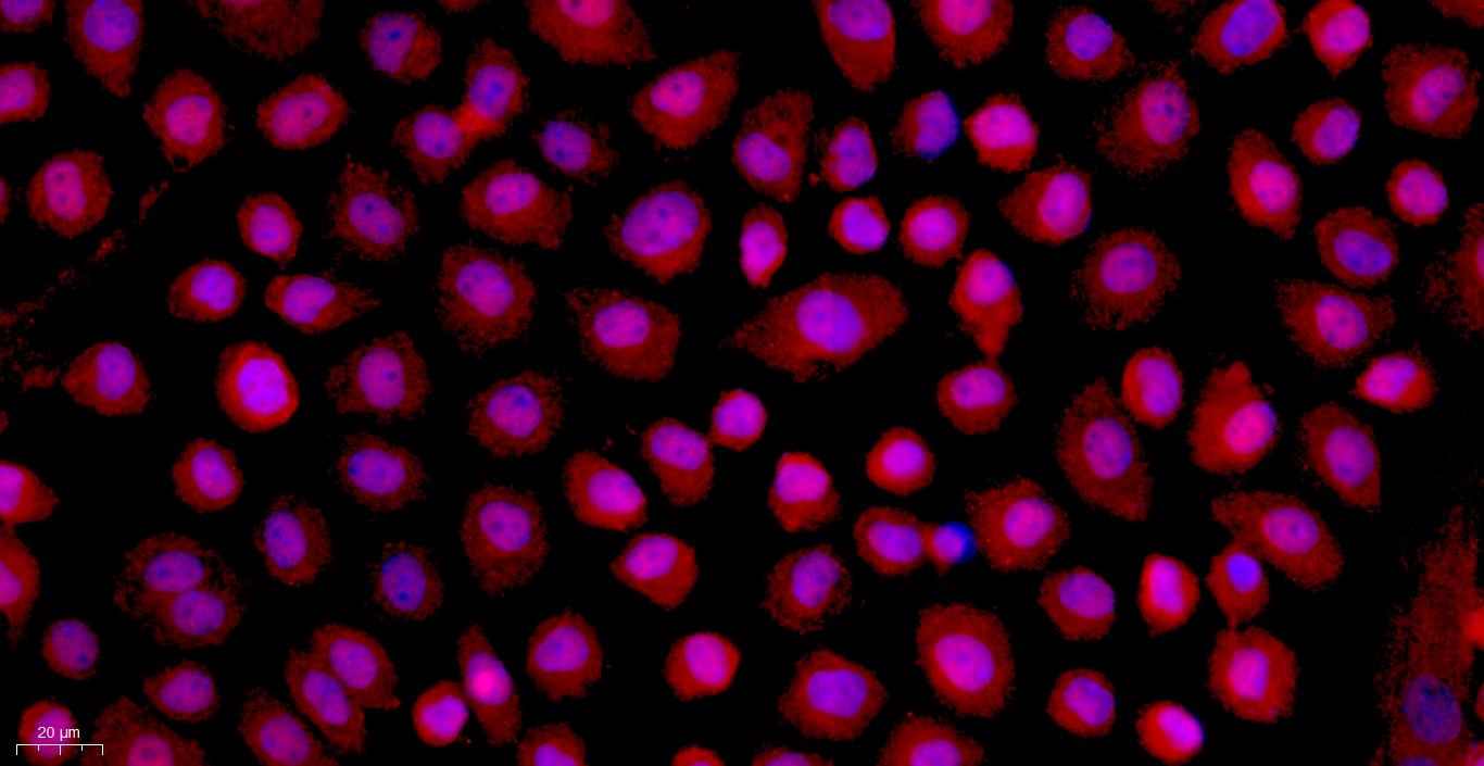 Primary Rat Peritoneal Mesothelial Cells (PMC)