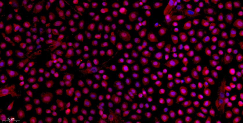 Primary Rat Peritoneal Mesothelial Cells (PMC)