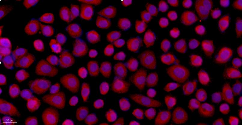 Primary Rat Peritoneal Mesothelial Cells (PMC)