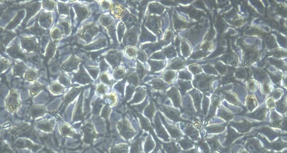 Primary Rabbit Peritoneal Mesothelial Cells (PMC)