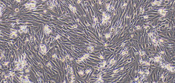 Primary Canine Ureteral Smooth Muscle Cells (USMC)