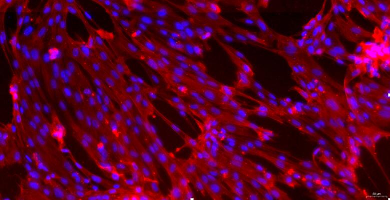 Primary Rabbit Ureteral Smooth Muscle Cells (USMC)