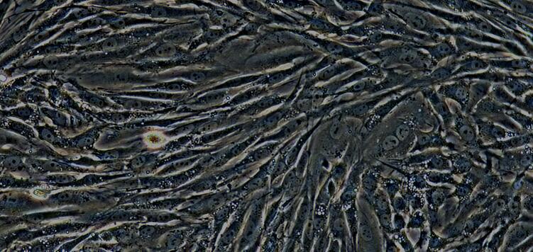 Primary Rabbit Urinary Tract Fibroblasts (UTF)