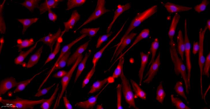 Primary Canine Corneal Stromal cells (CSC)