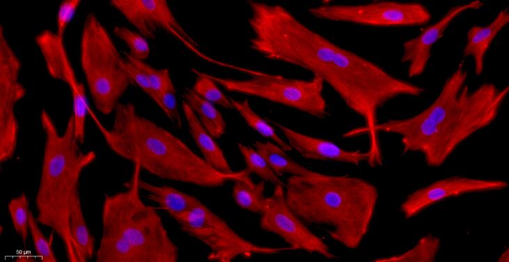 Primary Rabbit Corneal Stromal cells (CSC)