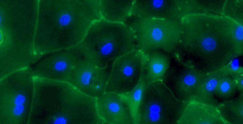 Primary Canine Ureteral Epithelial Cells (UEC)