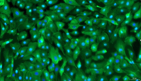 Primary Porcine Ureteral Epithelial Cells (UEC)