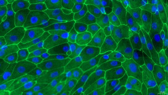 Primary Porcine Ureteral Epithelial Cells (UEC)