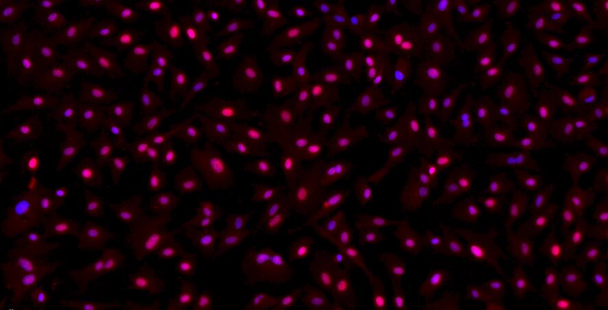 Primary Rabbit Meniscus Fibrochondrocytes (MFCs)