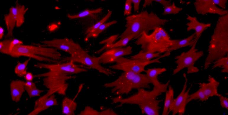 Primary Rabbit Small Airway Smooth Muscle Cells (SASMC)