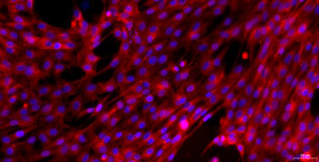 Primary Canine Corpus Cavernosum Smooth Muscle Cells (CCSM)