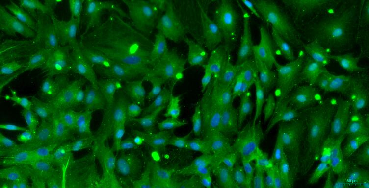 Primary Rat Oral Mucosal Fibroblasts (OMF)