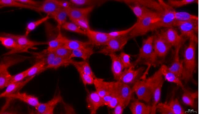 Primary Rat Arachnoid Cells (AC)