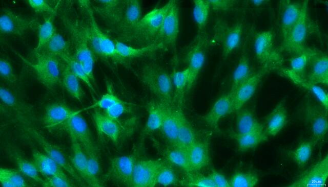 Primary Rat Arachnoid Cells (AC)