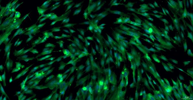 Primary Rat Vas Deferens Smooth Muscle Cells (VDSM)