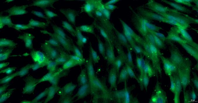 Primary Rat Vas Deferens Smooth Muscle Cells (VDSM)