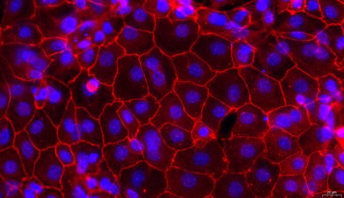 Primary Mouse Fallopian Tube Epithelial Cells (FTEC)