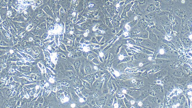 Primary Mouse Fallopian Tube Epithelial Cells (FTEC)