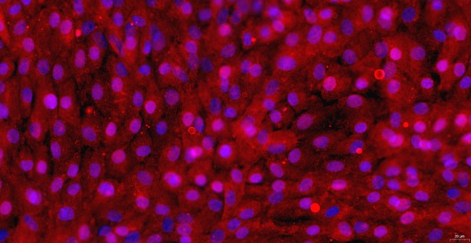 Primary Canine Tracheal Chondrocytes (TrC)