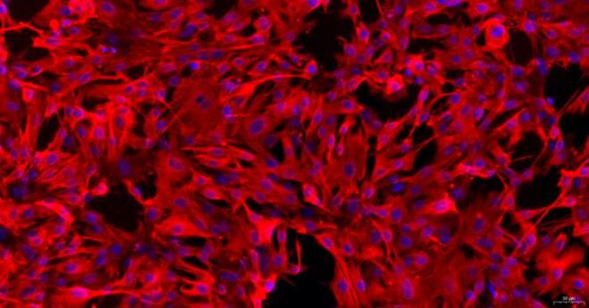 Primary Rabbit Cardiac Valve Interstitial Cells (CVIC)