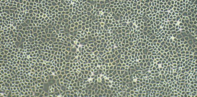 Primary Rat Pericardial Mesothelial Cells (PeMC)