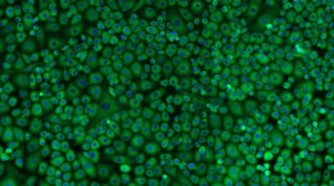 Primary Rat Pericardial Mesothelial Cells (PeMC)