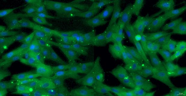 Primary Canine Inferior Vena Cava Smooth Muscle Cells ( IVCSMC)