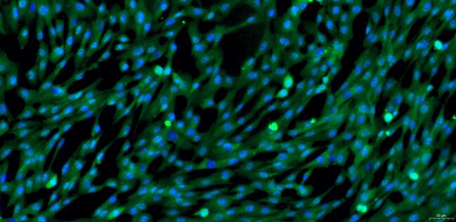 Primary Canine Endocardial Fibroblasts (EnCF)