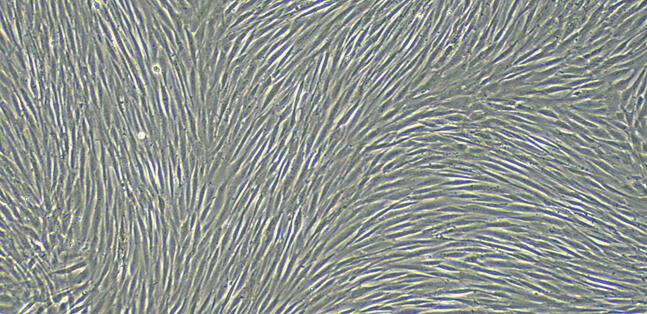 Primary Canine Endocardial Fibroblasts (EnCF)