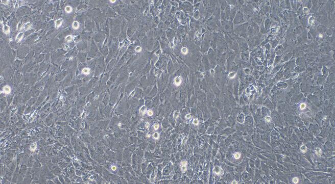 Primary Caprine Endocardial Fibroblasts (EnCF)