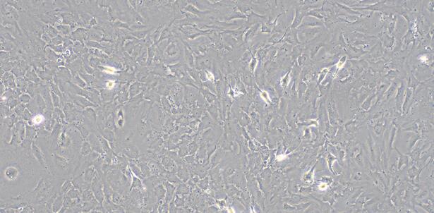 Primary Rat Endocardial Fibroblasts (EnCF)