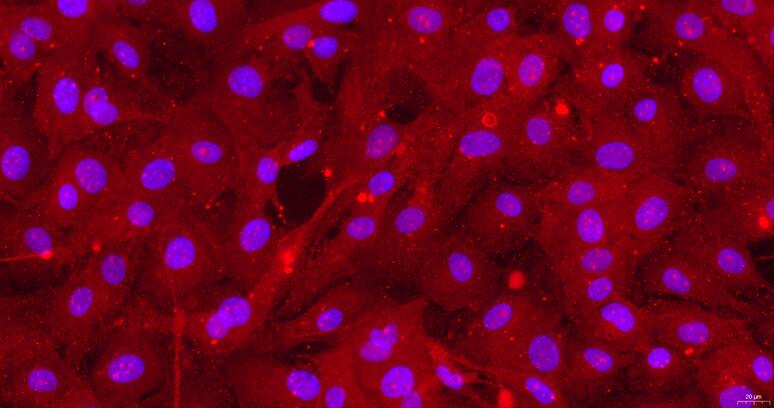 Primary Rat Endocardial Fibroblasts (EnCF)