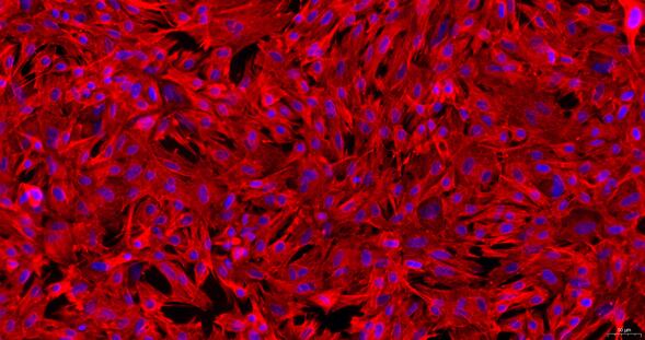 Primary Rabbit Endocardial Fibroblasts (EnCF)