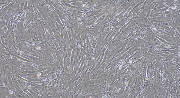 Primary Rabbit Endocardial Fibroblasts (EnCF)