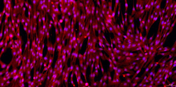 Primary Canine Epicardial Fibroblasts (EpCF)