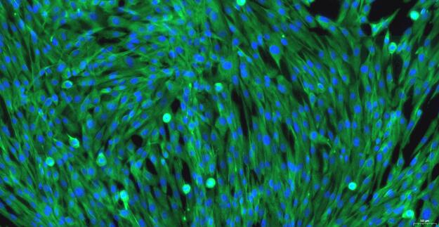 Primary Canine Epicardial Fibroblasts (EpCF)