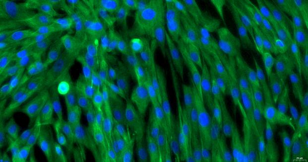 Primary Canine Epicardial Fibroblasts (EpCF)