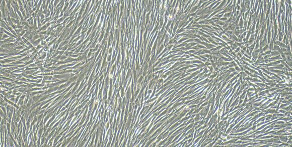 Primary Canine Epicardial Fibroblasts (EpCF)