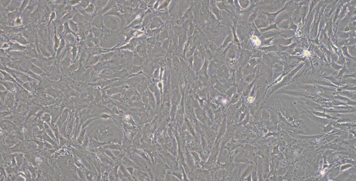 Primary Rabbit Epicardial Fibroblasts (EpCF)