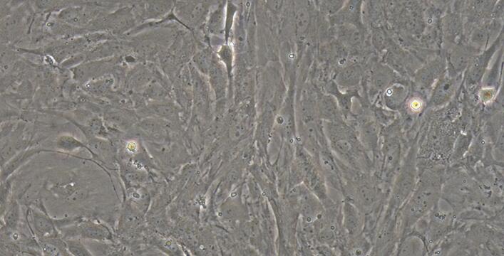 Primary Rabbit Epicardial Fibroblasts (EpCF)