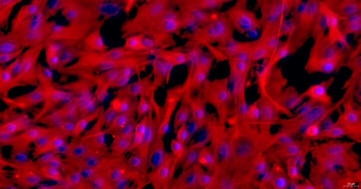 Primary Rabbit Epicardial Fibroblasts (EpCF)